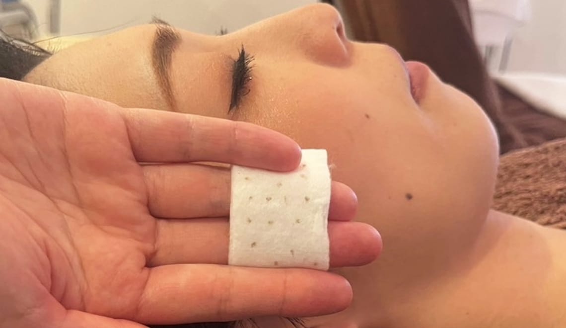 広島のシミ取り