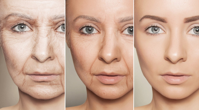 Beauty concept skin aging anti-aging procedures on caucasian woman face